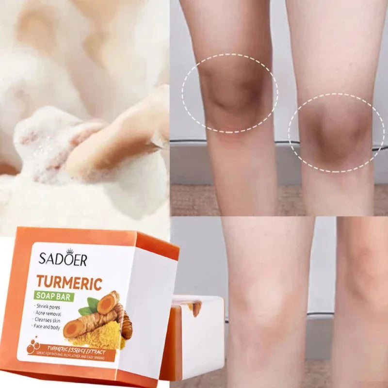 Sadoer Turmeric Body Soap Bar 100g