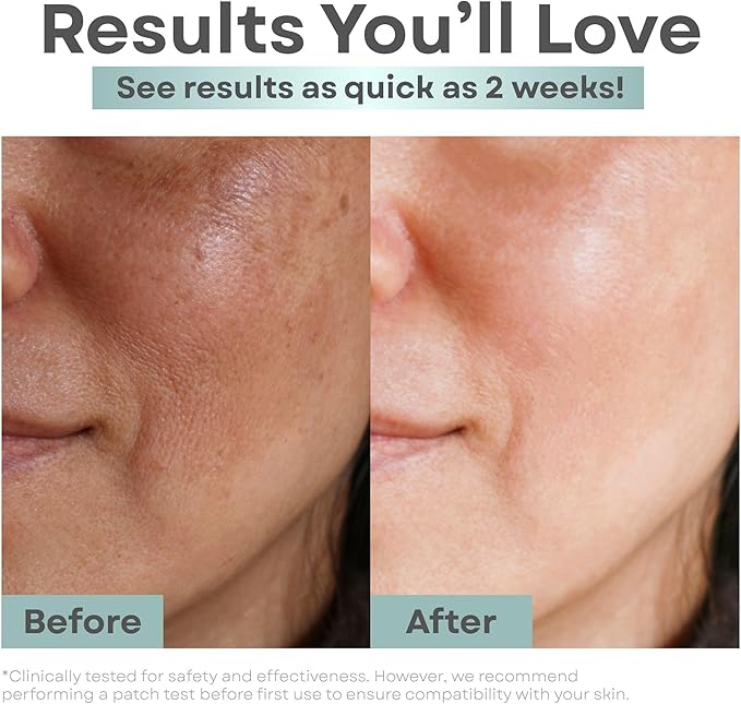 Clear Essence Anti-Aging Skin Toner Astringent with Alpha Hydroxy Acid 236ml