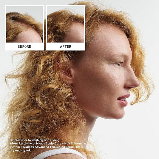Nioxin System 1 - Hair Thickening System For Natural Hair with Light Thinning Shampoo 1L