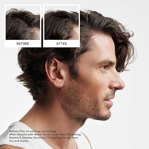 Nioxin Pro Clinical  2 Scalp + Hair Thickening Shampoo 1L