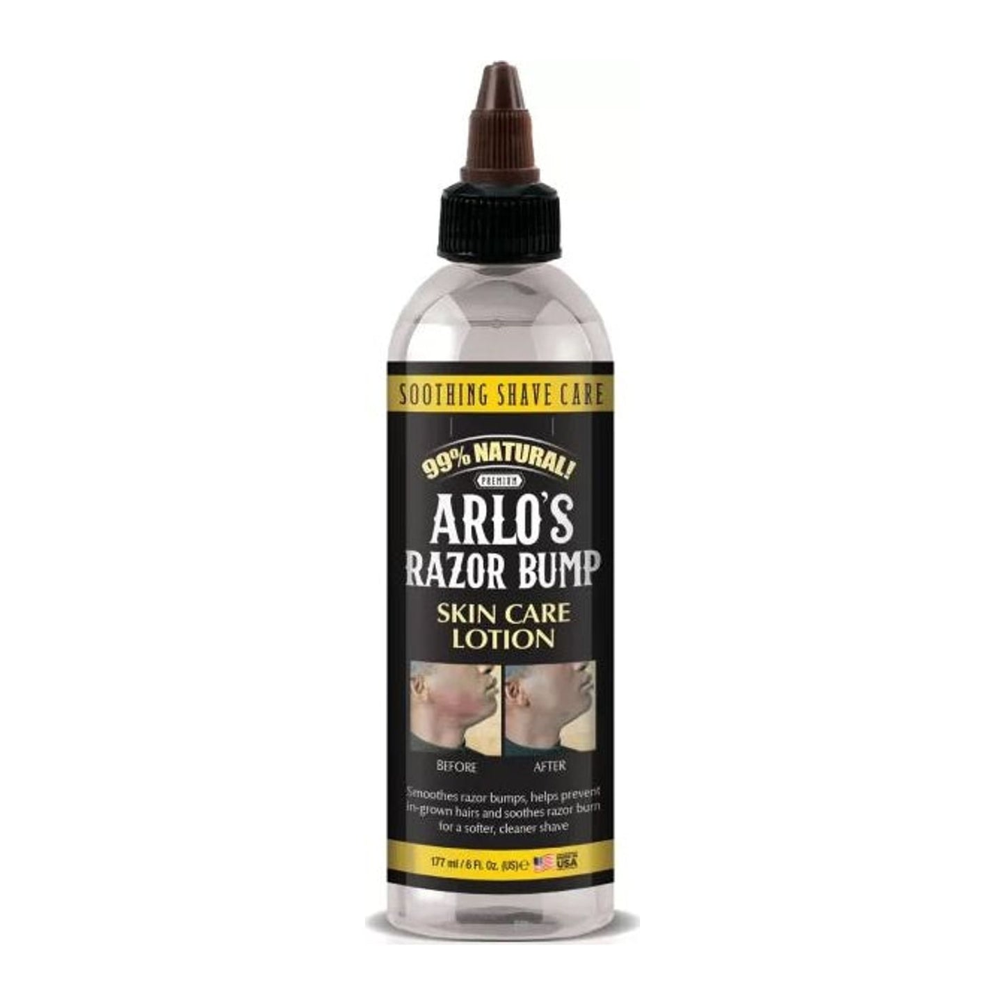 Arlo's Razor Bump Skin Care Lotion 177ml bottle for soothing razor bumps and razor burn