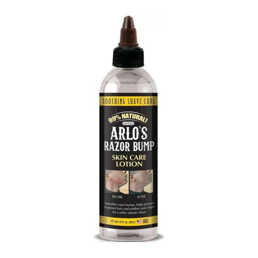 Arlo's Razor Bump Skin Care Lotion 177ml bottle for soothing razor bumps and razor burn