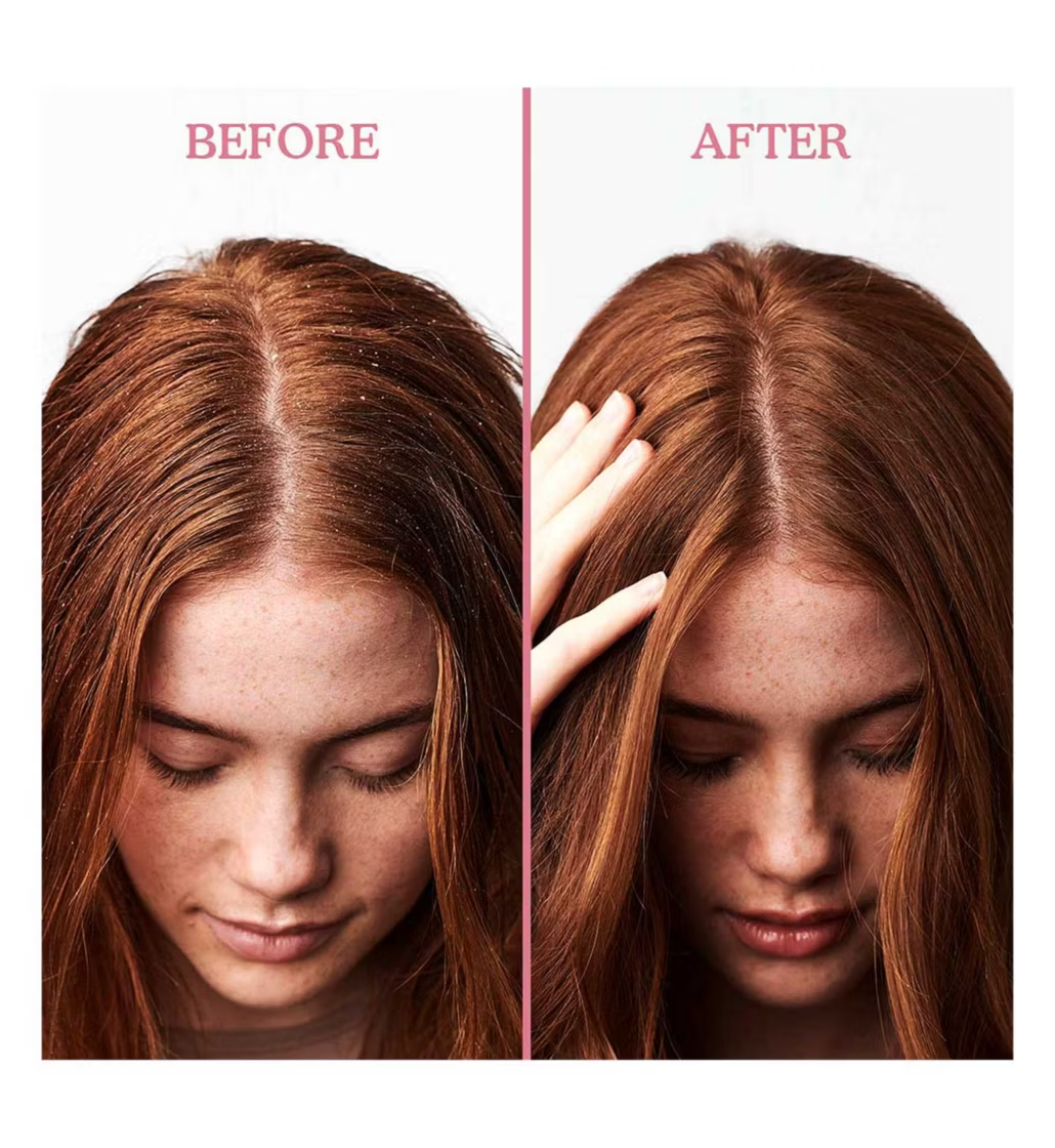 Umberto Giannini Scalp Restore Scalp Reviving Anti-Dandruff Conditioner 250ml