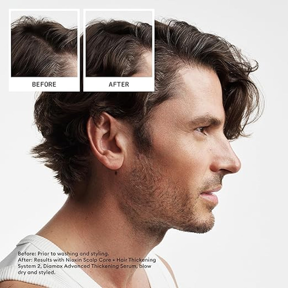 Nioxin System 2 Hair Thickening System - view 4